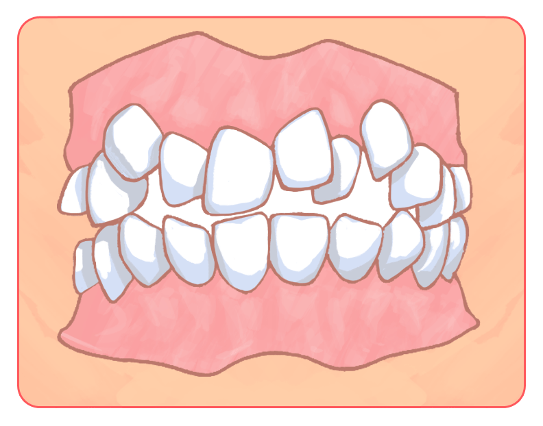 叢生(そうせい)