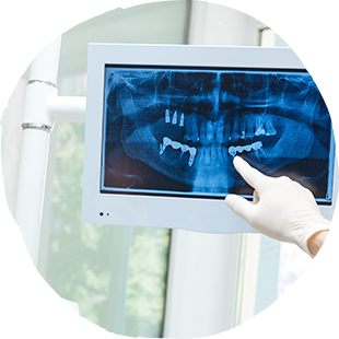 治療の「見える化」